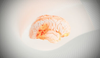 image of a brain