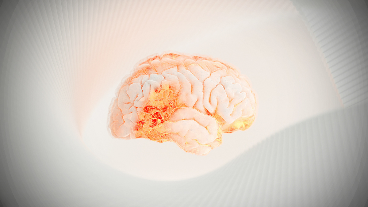 image of a brain